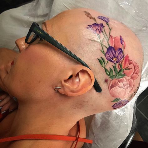 Alopecia tattoo - flower crown. Her first ever tattoo! Feminine Head Tattoo, Bald Head Tattoos Women, Scalp Tattoo Women, Head Tattoo Hair, Bald Head Tattoo, Scalp Tattoo, Tattoo Hair, Head Tattoo, Tattoo Women