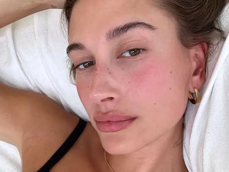 Hailey Bieber with strawberry makeup Burberry Nails, Henna Kit, Fake Freckles, Fall Lips, Summer Skincare Routine, Faux Freckles, Summer Skincare, Benefit Cosmetics, Glossy Lips