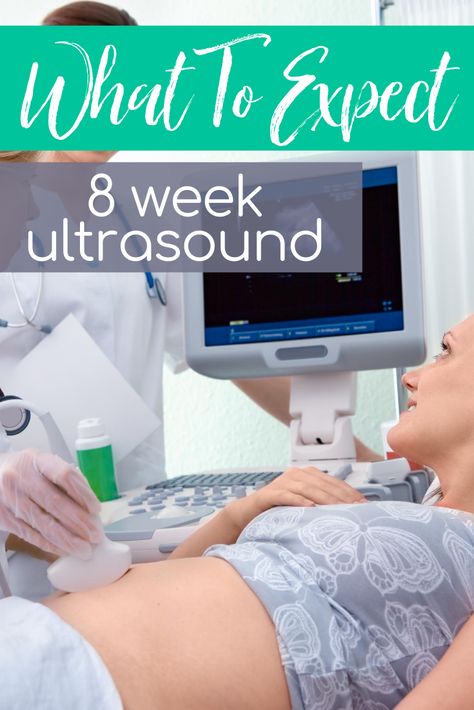 Wondering what to expect at your 8 week ultrasound appointment? First of all, congrats mama on your pregnancy, yay! Now that the news have set it or not, still surprised? It’s time for your first prenatal visit! What to expect at your 8 week ultrasound appointment? A lot of exciting things.  Many doctors like to schedule your first prenatal appointment at your 8 week mark. This is because a fetus and heartbeat is usually confirmed and visible at this point. Ultrasound Appointment Outfit, Prenatal Appointment Schedule, Pregnancy 8 Weeks, 8 Weeks Pregnant Ultrasound, 7 Week Ultrasound, 8 Week Ultrasound, 8 Weeks Pregnant, First Prenatal Visit, First Prenatal Appointment