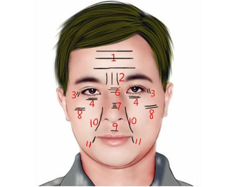 Facial Lines and Wrinkles Face Reading: Crow's-feet, Lines on Forehead, Nose, Under Eyes Lines On Forehead, Chinese Face Reading, Reading Techniques, Bridal Facial, Wrinkles On Face, Nose Wrinkles, Aloe Vera Skin Care, Instant Face Lift, Face Reading