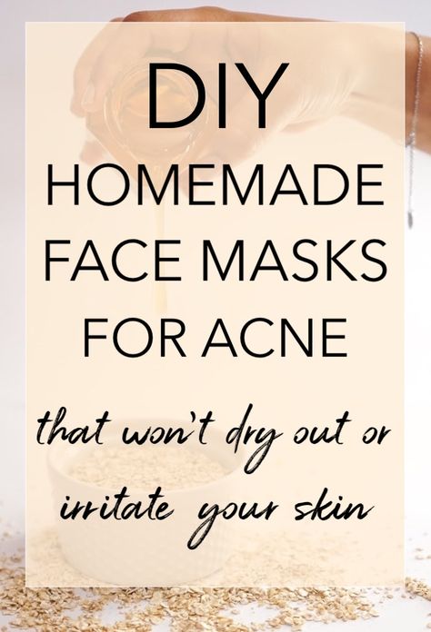 DIY Face Masks For Acne and Oily Skin #homefacemask #diyfacemask #homemadefacemask #acnefacemask #oilyskin #acneprone Homemade Face Masks For Acne, Face Masks For Acne, Masks For Acne, Acne Products, Mask For Oily Skin, Acne Overnight, Acne Mask, Diy Beauty Treatments, Skin Face Mask