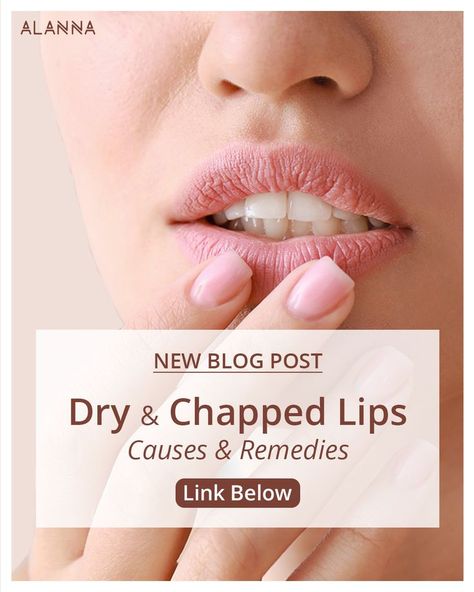 Causes and treatment of dry and chapped lips Remedies For Chapped Lips, Very Dry Lips, Lip Salve, Salve Recipes, Natural Face Cleanser, Get Scared, Practicing Mindfulness, Banana Drinks, Yeast Infections