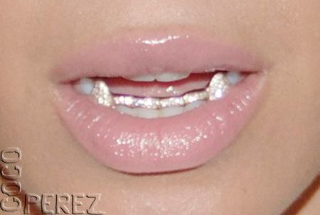 Gold Teeth Grills, Girl Grillz, Teeth Gems, Pretty Teeth, Grillz Teeth, Diamond Grillz, Gold Grill, Diamond Teeth, Tooth Gems