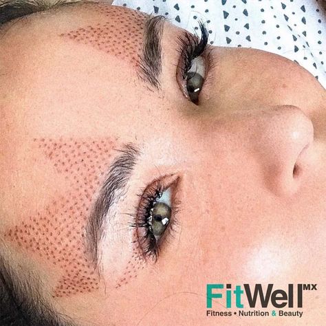 Plasma Fibroblasting – All Your Questions Answered Plasma Facial, Mircoblading Eyebrows, Skin Tightening Procedures, Facial Procedure, Eyebrow Lift, Skin Tightening Treatments, Skin Aesthetics, Facial Aesthetics, Skin Science