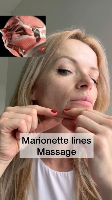 Marionette Lines Makeup, Droopy Mouth Facial Exercises, Frown Lines Around Mouth, Marionette Lines Filler, Get Rid Of Marionette Lines, Face Yoga Droopy Mouth, Face Yoga Marionette Lines, Lines Around Mouth, Marionette Lines