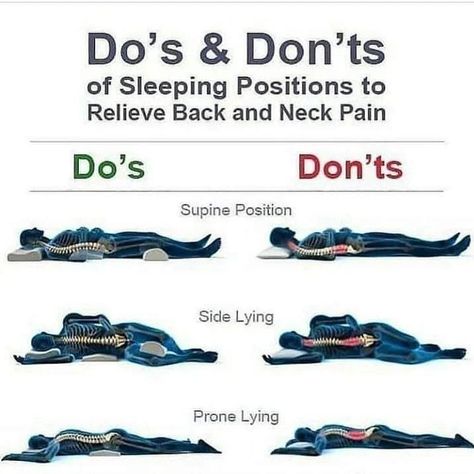 The Do's and Don't of sleeping positions to relieve back and neck pain . . . . #healthylifestyle #healthyliving #healthylife #healthychoices #healthyhabits #healthybody #healthychoice #healthychoicesmatter Sleep Posture, Sciatica Pain Relief, Lower Back Pain Exercises, Ways To Sleep, Lower Back Pain Relief, Sciatica Pain, Sleep Health, Do's And Don'ts, Back Pain Exercises