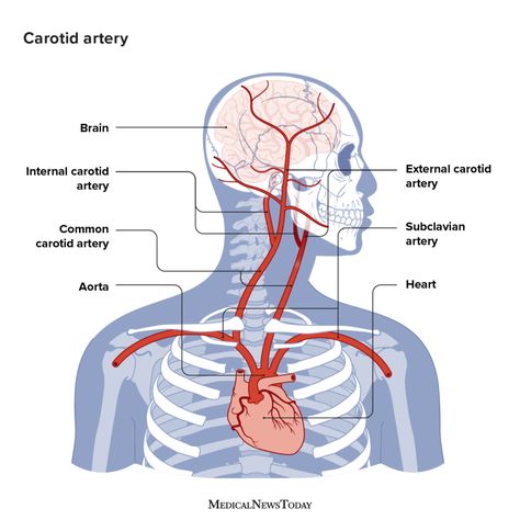 Carotid artery neck pain: Symptoms, causes, and more Fat Burning Lunch, Arteries Anatomy, Unclog Arteries, Internal Carotid Artery, Radiology Technician, Text Neck, Medicine Notes, Carotid Artery, Pinched Nerve