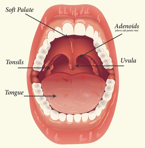 Enlarged Tonsils in Children - New Kids Center Enlarged Tonsils, Throat Anatomy, Tonsils And Adenoids, Soft Palate, Yoga Information, Asthma Attacks, Homeopathic Medicine, Homeopathy, Herbal Remedies