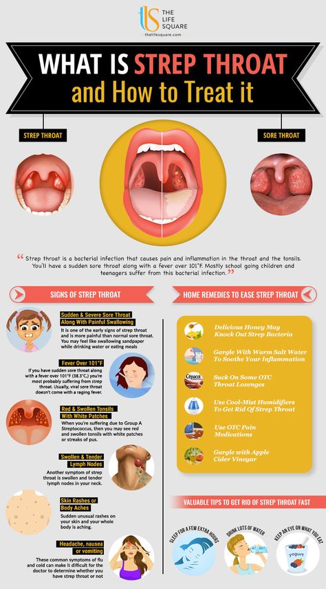 Warning Signs Of Strep Throat Signs Of Strep Throat, Sore Throat Remedies For Adults, Strep Throat Remedies, Sickness Remedies, Dry Cough Remedies, Sore Throat Remedies, Throat Remedies, Throat Pain, Throat Infection