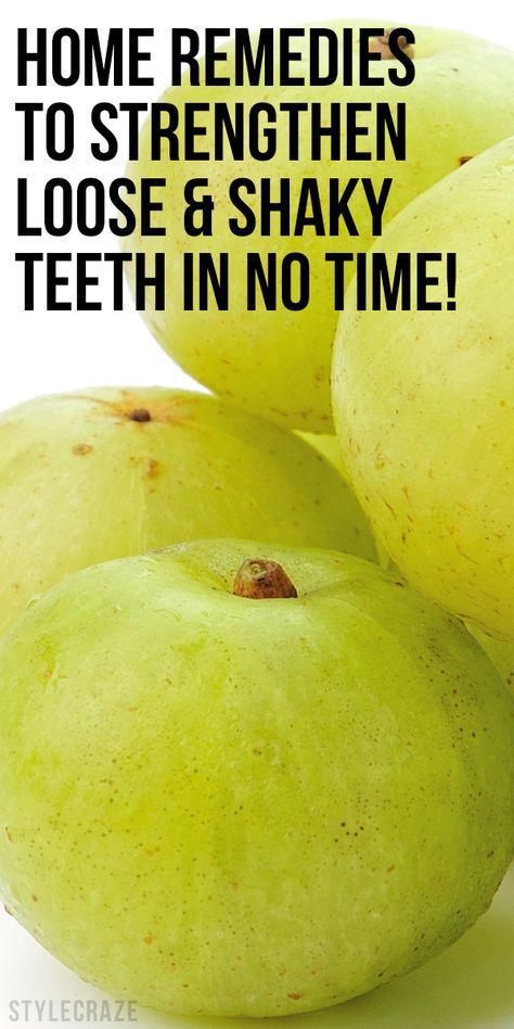 Loose Teeth, Teeth Remedies, Strengthen Teeth, Teeth Whitening Remedies, Loose Tooth, Teeth Health, Best Teeth Whitening, Oral Care Routine, Receding Gums