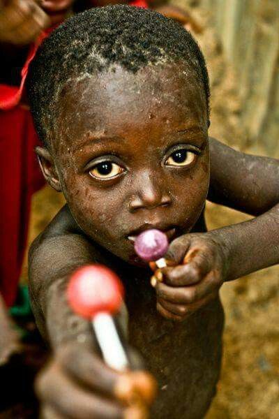 Poverty Photography, Hand And Foot Care, African Children, Poor Children, Poor People, People Photography, Children Photography, Beauty Care, Skin Care Tips