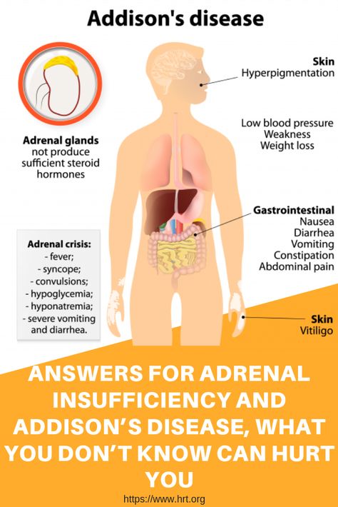 Disease Quote, Extreme Fatigue, Addison's Disease, Addisons Disease, Endocrine Disorders, Adrenal Health, Skin Hyperpigmentation, Disease Symptoms, Dancer Workout