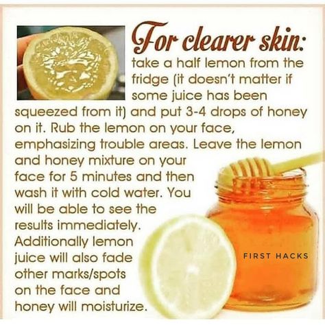 Hydrogen Peroxide Skin, Natural Aging Skin Care, Clear Skin Remedies, Lemon On Face, Clear Skin Naturally, Lemon Honey, Honey Face, Benefits Of Coconut Oil, Coconut Oil For Skin