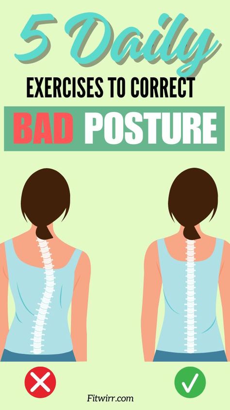 This pin features the pin title "5 daily exercises to correct bad posture", and graphics of woman who has an improved better and straighter back posture and the before image where her back posture is poor. How To Straighten Posture, Straighten Posture Exercise, Back Strengthening Exercises Bad Posture, Straighten Back Improve Posture, Exercises For Posture Correction, How To Correct Bad Posture, How To Correct Posture, Bad Posture Exercises, Stretches For Your Back