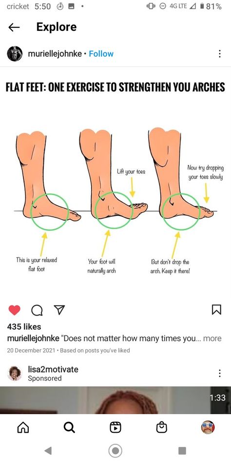 Exercise to build arch of foot Fix Flat Feet Arches, How To Fix Flat Feet Exercise, Arch Strengthening Exercises, Foot Arch Exercises, Fallen Arches Exercises, Shoe Dictionary, Flat Feet Exercises, Gym Girlies, Ballet Barre Workout