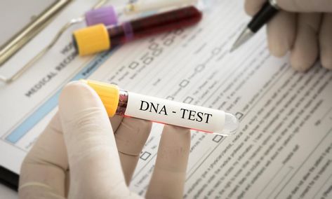 NY Times, Why Are You So Worried About 23andMe's Genetic Tests? FORBES 2/4/19 Home Safety Tips, Dna Test Results, Cholesterol Test, Genealogy Websites, Dna Results, Cholesterol Remedies, Cholesterol Lowering Foods, Lower Your Cholesterol, Hdl Cholesterol