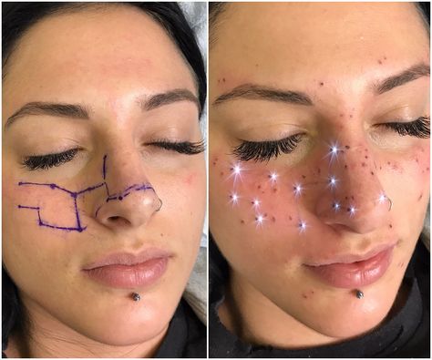 Dots On Face, Piercing No Rosto, Makeup Artist Tattoo, Tattooed Freckles, Facial Markings, Shape Tattoo, Zodiac Sign Tattoos, Constellation Tattoos, Cosmetic Tattoo