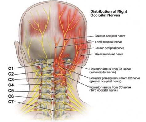 Occipital Nerve Block, Punkty Spustowe, Nerve Anatomy, Occipital Neuralgia, Chiari Malformation, Head Pain, Chronic Migraines, Headache Relief, Migraine Headaches