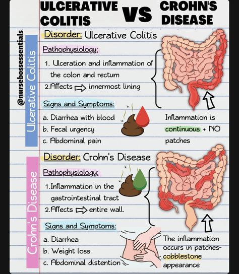 Pathophysiology Nursing, Nursing School Studying Cheat Sheets, Nursing Information, Nursing School Essential, Medical School Life, Nursing School Motivation, Nurse Study Notes, Nursing Mnemonics, Nursing Student Tips