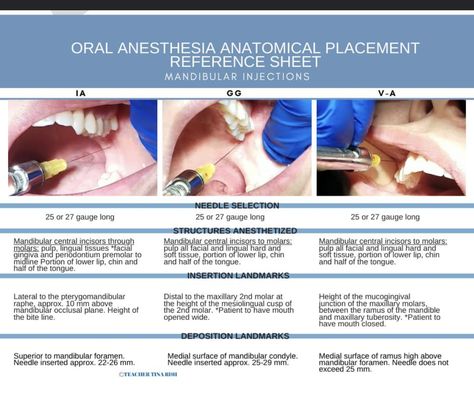 Dental Anesthesia, Dental Assistant Study, Dentist Office Design, Dental Hygiene School, Dental Anatomy, Dental Fun, Clinic Logo, Dental Facts, Teeth Shape