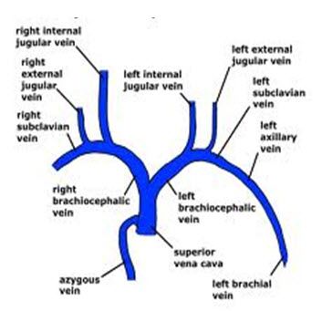 Major veins superior to the heart Ct Anatomy, Superior Vena Cava, Ultrasound Notes, Arteries Anatomy, Central Venous Catheter, Med School Study, Vascular Ultrasound, Batman Painting, Ultrasound Technician