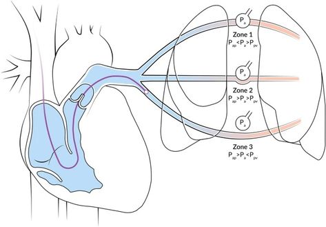 The contemporary pulmonary artery catheter. Part 1: placement and waveform analysis | Journal of Clinical Monitoring and Computing Hemodynamic Monitoring, History