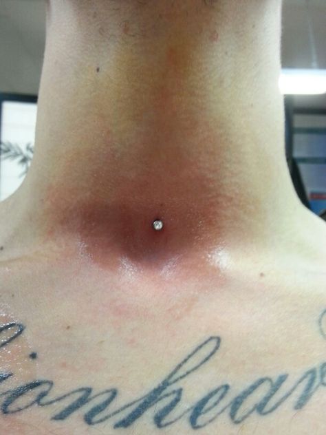 Neck  dermal Neck Piercing Dermal, Back Of Neck Dermal Piercing, Dermal Piercing Clavicle, Neck Dermal, Back Dermal Piercing With Tattoo, Back Dermal With Tattoo, Neck Piercing, Sternum Piercing Surface Dermal Anchor, Dermal Piercing