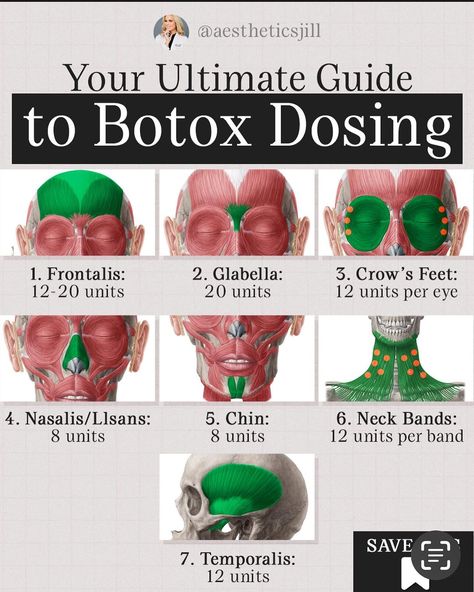 Jill Campbell - Houston Nurse Practitioner | ▪️Botox dosing.... ▪️Although everyone is unique, here are some general guidelines to consider. ▪️Dosing recommendations from the maker... | Instagram Botox Injection Patterns, Christmas Botox Specials, Botox Reconstitution Chart, Before And After Botox Pictures, Botox Anatomy, Botox Around Mouth, Botox Injection Sites, Injection Sites, Botox Facial