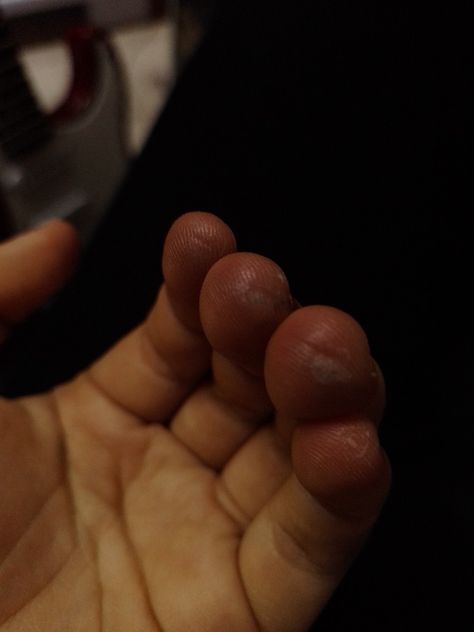 . Guitarist Fingers, Finger Bandages, Guitar Fingers, Weird Girl, Core Core, Finger Guard, Play Guitar, Ap Art, Playing Guitar