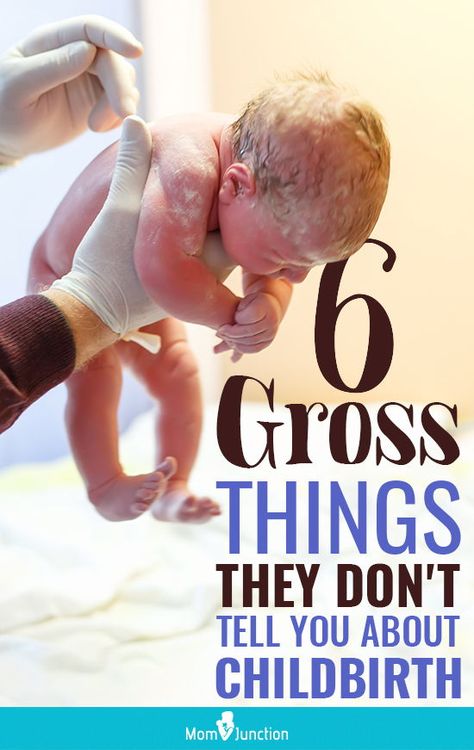 Gross Things, Delivering A Baby, Delivery Room, Mom Junction, Baby Care Tips, Pregnancy Care, Giving Birth, Kids Discover, Newborn Care