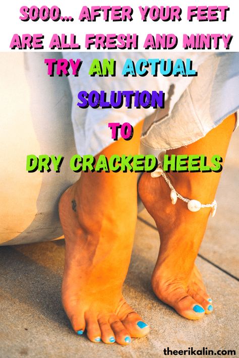 hydrogen peroxide soak for dry cracked heels. Remove dead skin from feet. Diy Cracked Heel Remedy, Cracked Heel Remedies, Heal Cracked Heels, Diy Foot Soak, Foot Soak Recipe, Dry Cracked Heels, Dry Heels, Soft Heels, Foot Soak