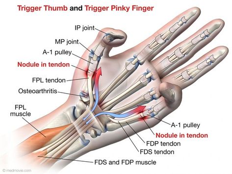 Hand Massages, Wrist Anatomy, Arms Muscles, Vintage Nursing, Hand Anatomy, Ulnar Nerve, Elbow Pain, Medical Student Study, Trigger Finger