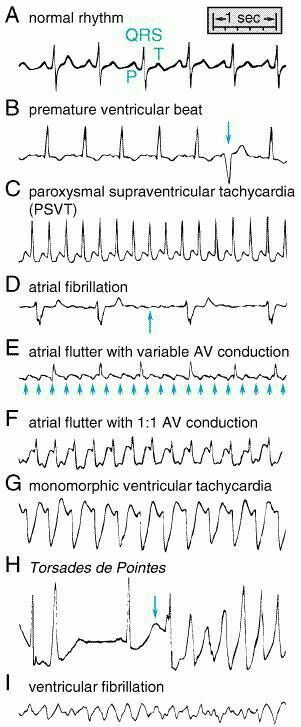 Nursing Cheat, Cardiac Nursing, Respiratory Therapy, Nursing School Tips, Nursing Tips, Nursing Assistant, Nursing Study, Nursing Education, Nursing Notes