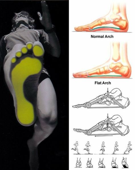 Shoes Sketch, Sneakers Sketch, Foot Anatomy, Foot Shoes, Flat Foot, Futuristic Shoes, Shoe Sketches, Insole Design, Sneaker Design