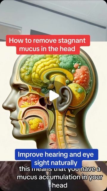 Mucus Relief Remedies How To Get Rid, Natural Mucus Remover, Remove Mucus From Lungs, Clear Lungs Of Mucus, How To Expel Mucus, How To Clear Lungs Of Mucus, How To Clear Your Lungs Of Mucus, Mucoid Plaque, Mucus Relief