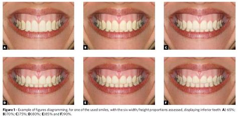 Influence of different width/height ratio of maxillary anterior ... Types Of Teeth Shapes, Different Types Of Teeth, Types Of Teeth, Seattle Tacoma International Airport, Dental Smile, Facial Plastic Surgery, Teeth Shape, Types Of Plastics, Facial Plastic