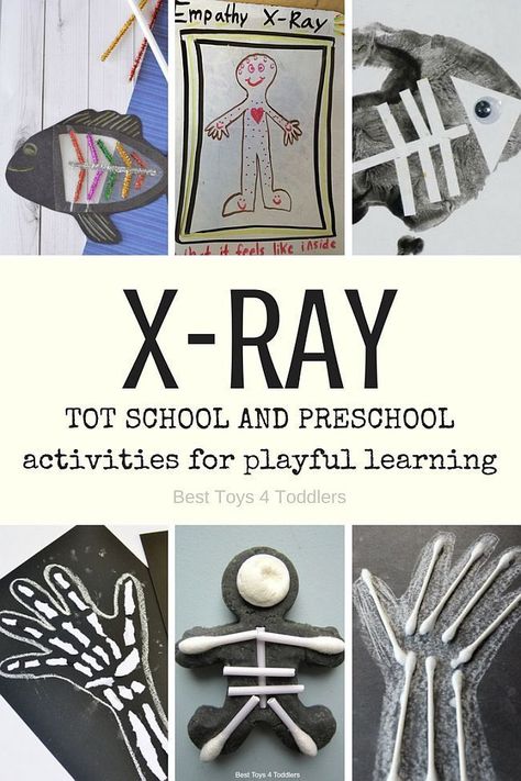 Best Toys 4 Toddlers - letter X for X-ray - 7 days of preplanned activities for tot school and preschool Letter X Activities, Prophet Ezekiel, February Activities, Community Helpers Preschool, X Rays, Library Lessons, Preschool Letters, Letter X, Letter Activities