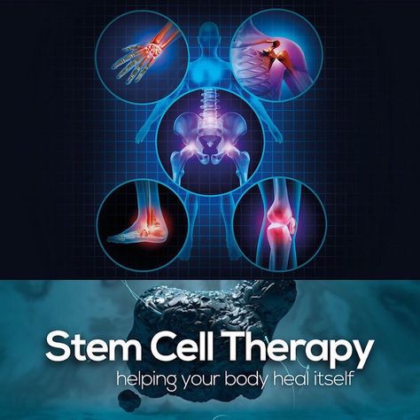 Cord Blood Banking, Umbilical Cord, Med Tech, Stem Cell Therapy, Cell Therapy, Regenerative Medicine, Growth Factor, Body Healing, Sports Medicine