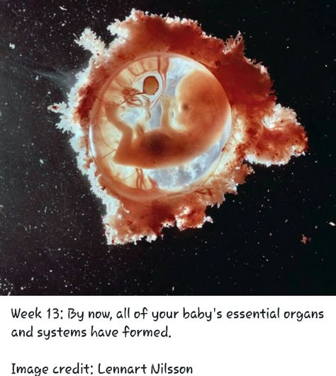 Embryology Aesthetic, Baby In Womb, Doctor Quotes Medical, Gym Workout Apps, Human Embryo, Microscopic Photography, Baby Inside, Medical Anatomy, Alien Art