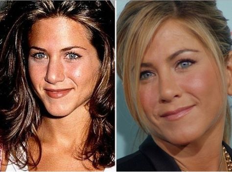 Jennifer Anniston. Plastic Surgery. Cosmetic Surgery. Plastic Sugery Sydney. Beauty. www.silkwoodmedical.com.au Jennifer Aniston Nose Job, Jennifer Aniston Nose, Kim Kardashian Before, Beauty And The Beat, Celebrity Plastic Surgery, Celebrities Before And After, Hollywood Gossip, Nose Job, After Photos