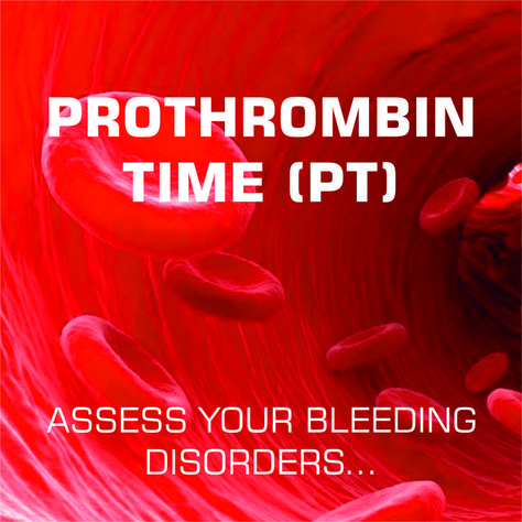 A prothrombin time (PT) is a blood test used to help identify & diagnose bleeding disorders or clotting disorders in your circulatory system. It tells you how long it takes your blood to clot. it’s used to monitor how well the blood-thinning medication (anticoagulant) is working to prevent blood clotting in your body. Prothrombin Time, Blood Clotting, 8th Sign, Migraine Headaches, General Knowledge Facts, Circulatory System, Blood Test, Healing Process, General Knowledge