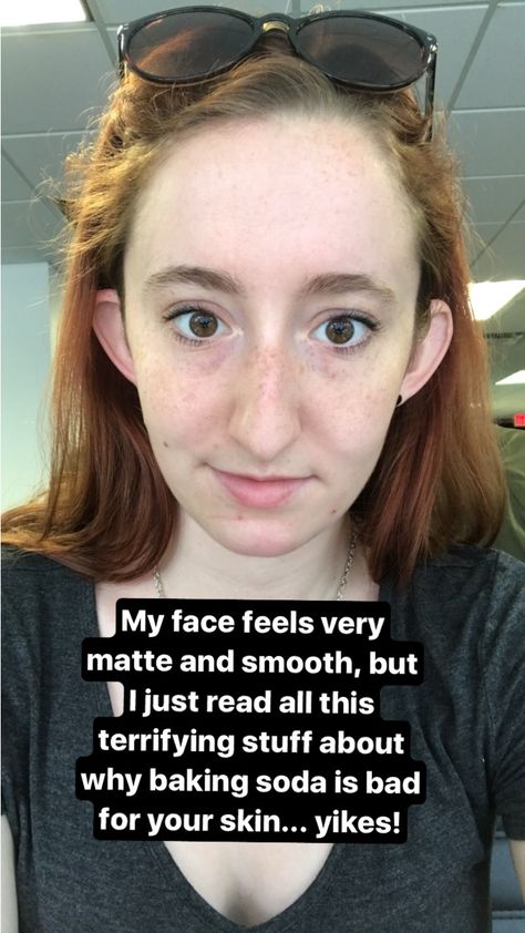 LittleThings.com : Baking Soda Face Wash Controversy : I Smeared Baking Soda On My Face Every Night For A Week. Here's How My Skin Looked 7 Days Later -- However, I eventually read about the potential negative effects. It wasn't until after I'd been using baking soda on my face for a few days that I found out how baking soda could negatively impact my skin. I read multiple studies from Dermatology, the International Journal of Cosmetic Science, and Acta Dermato-venereologica about the ways in... Baking Soda Face Wash, Baking Soda Dry Shampoo, Low Thyroid Remedies, Diy Shampoo Recipe, Benefits Of Baking Soda, Ingrown Hair Remedies, Baking Soda For Hair, Baking Soda Face, Baking Soda Benefits