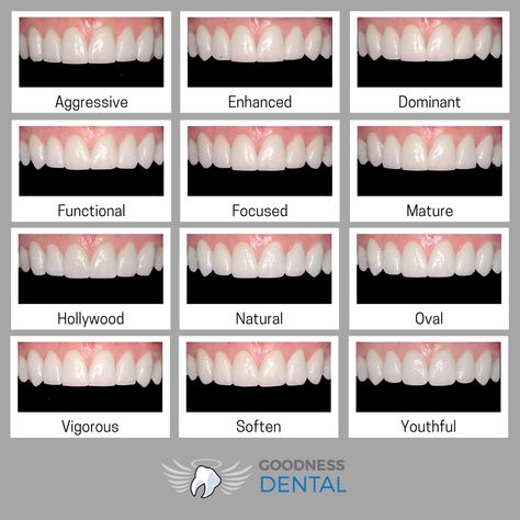 Round Teeth Shape, Fang Teeth Natural, Types Of Teeth Shapes, Pretty Teeth Smile, Teeth Bonding Before And After, Natural Fangs Teeth, Teeth Fangs Natural, Perfect Teeth Aesthetic, Fangs Smile