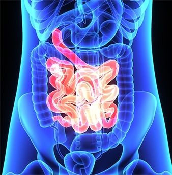 3 Reasons Why People Over 60 Need Probiotics - Organixx Gut Problems, Gastrointestinal Disease, Small Intestine Bacterial Overgrowth, Irritable Bowel, Gut Healing, Types Of Cancers, How To, Probiotics, Disease