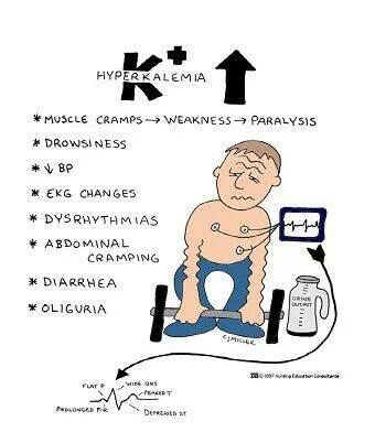 ~Symptoms of Hyperkalemia~ Causes: kidney trouble, aldactone-makes you retain potassium S/S: Begins with muscle twitching, then proceeds to weakness, then flaccid paralysis, could develop life-threatening arrythmias Tx: dialysis, calcium gluconate to decrease arrythmias, Glucose and insulin because insulin carries glucose and potassium into the cell; sodium polystyrene sulfonate (Kayexalate) Nursing Information, Nursing Mnemonics, Fluid And Electrolytes, Surgical Nursing, Nursing School Survival, Nursing School Studying, Nursing School Tips, Nursing School Notes, Nursing Career