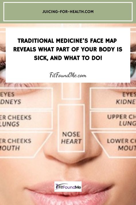 For thousands of years, Chinese healers have been reading faces to detect and diagnose all kinds of diseases… Chinese Face Map, Chinese Face Reading, Face Map, Face Mapping, Face Reading, Body Map, Juicing For Health, Traditional Medicine, Chinese Medicine