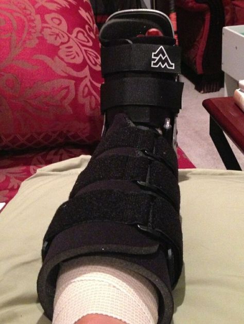 Knee Brace Outfit, Walking Cast, Broken Foot, Ankle Surgery, Hospital Admit Hand Pics, Broken Ankle, Hospital Photography, Leg Cast, Leg Injury