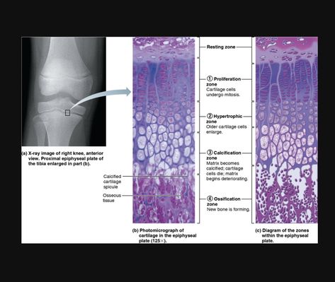 Epiphyseal Plate, X-ray Images, Medical School, X Ray, Biology, Bones, Medical, Crochet, Quick Saves