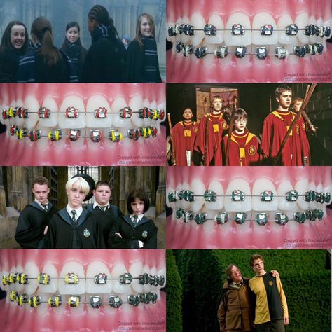 Harry Potter Hogwarts braces colours – bracemateapp Harry Potter Braces Colors, Brace Tips, Invisalign Tips, Braces Colours, Braces Colors Combinations, Braces Ideas, Cute Braces Colors, Harry Potter Colors, Dental Advertising