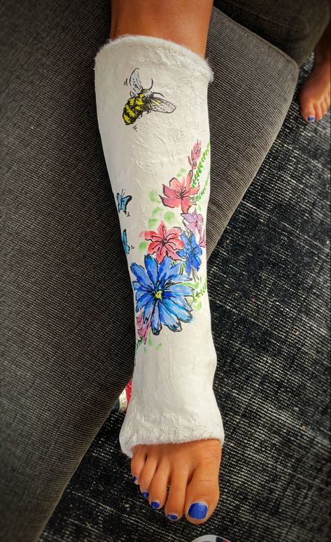 Floral flower design for cast Cast Drawing Ideas Leg, Leg Cast Decorating Ideas, Cast Painting Leg, Cast Decorating Ideas Leg, Painting Legs Art Ideas, Cast Designs Leg, Cast Art Leg, Painted Legs Body Art, Hand Fracture